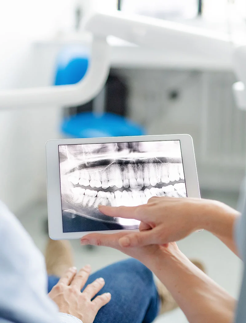 Failing Dental Implants