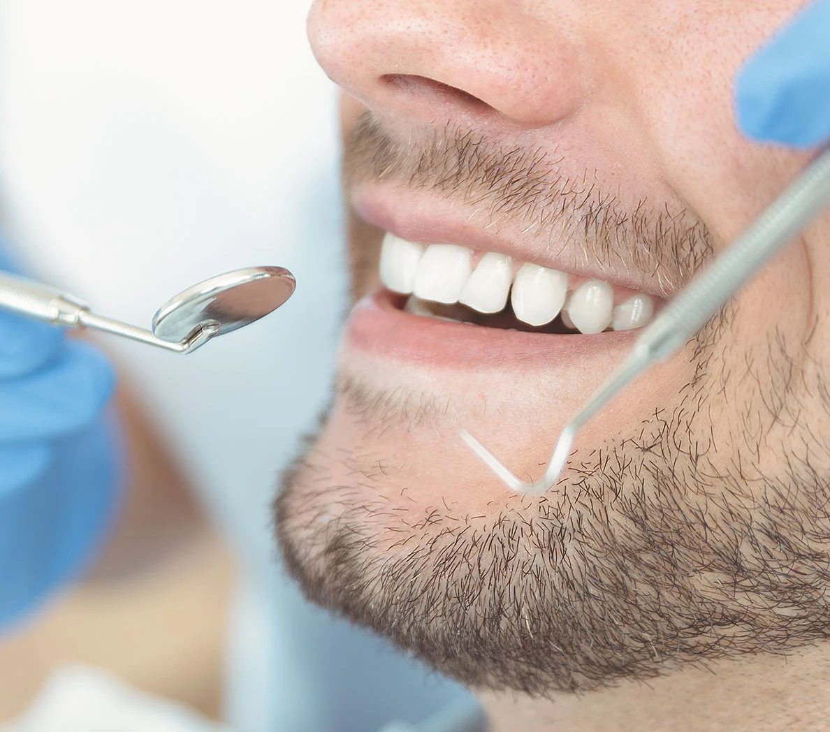 Help With Failing, Missing, or Knocked-Out Teeth