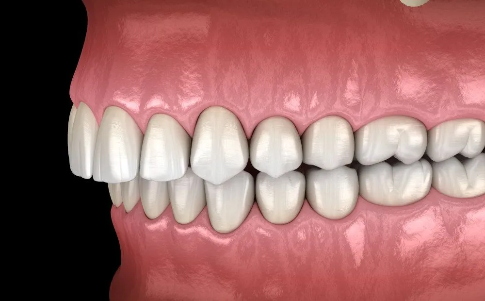 Our Dental Membership Plan