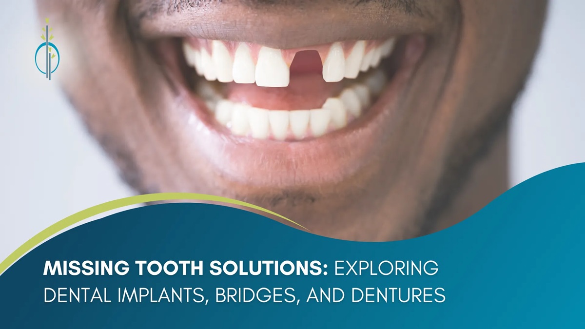 missing-tooth-solutions-exploring-dental-implants-bridges-and-dentures