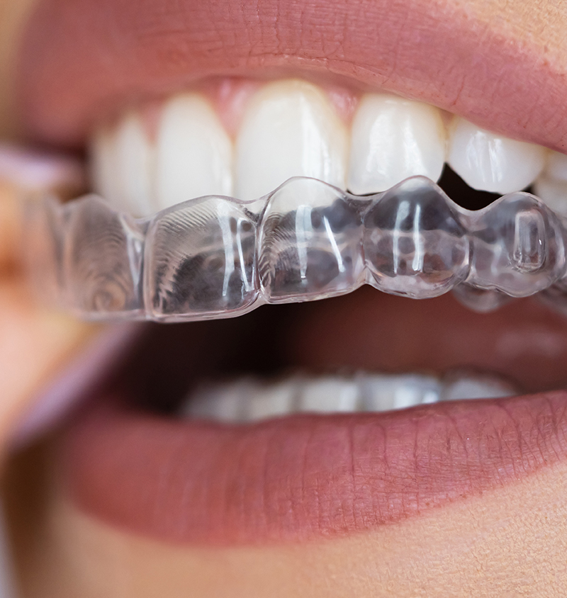 Treatments Available For Toothaches and Sensitive Teeth