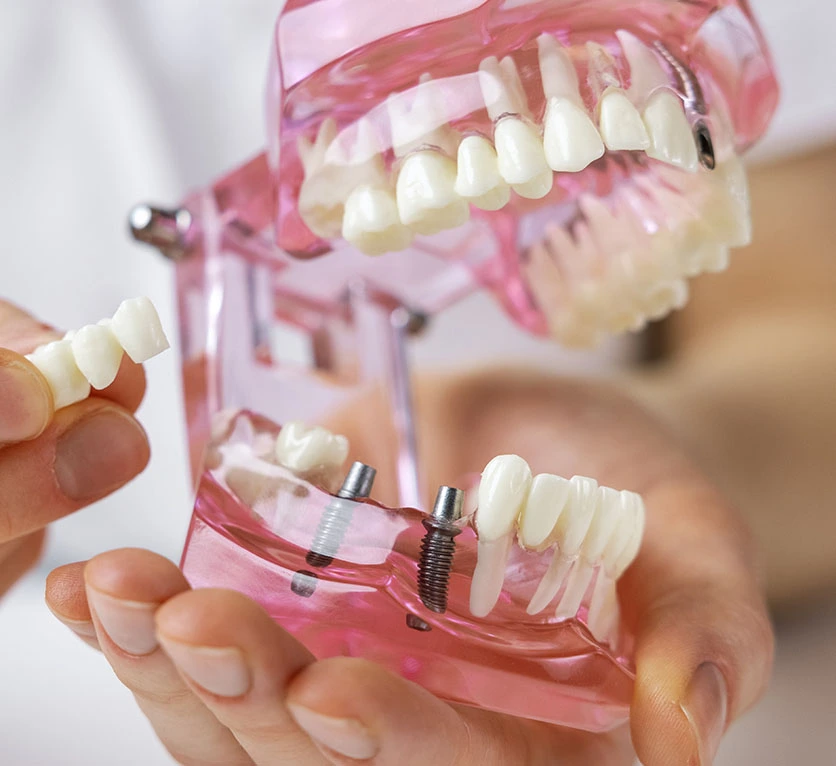 Patient receiving dental crown or bridge treatment in Deerfield Beach dental office
