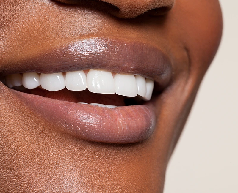 Patient receiving dental crown or bridge treatment in Deerfield Beach dental office