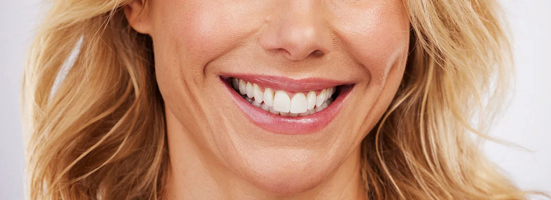 Patient receiving Zoom teeth whitening treatment in Deerfield Beach